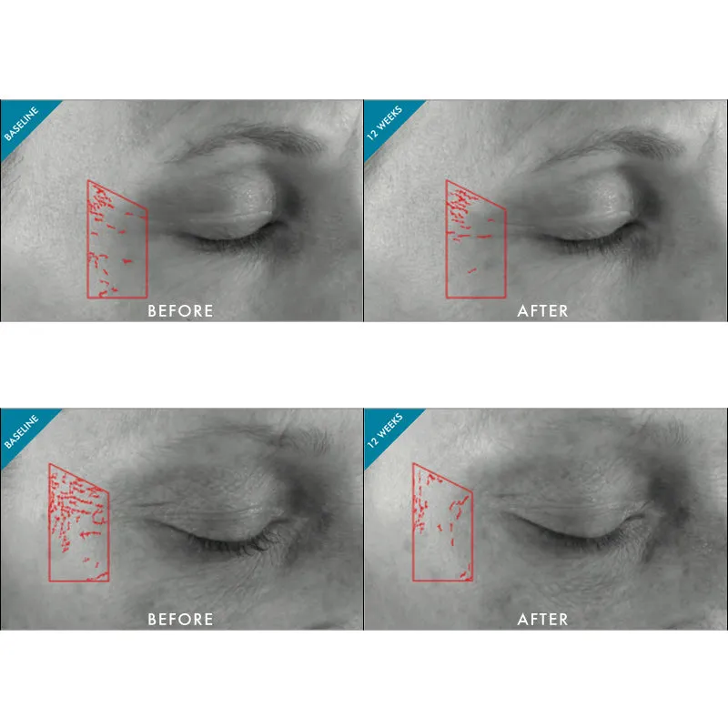 SkinCeuticals Metacell Renewal B3