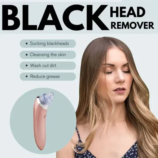 SmartMart® Blackheads Remover Vacuum
