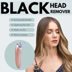 SmartMart® Blackheads Remover Vacuum
