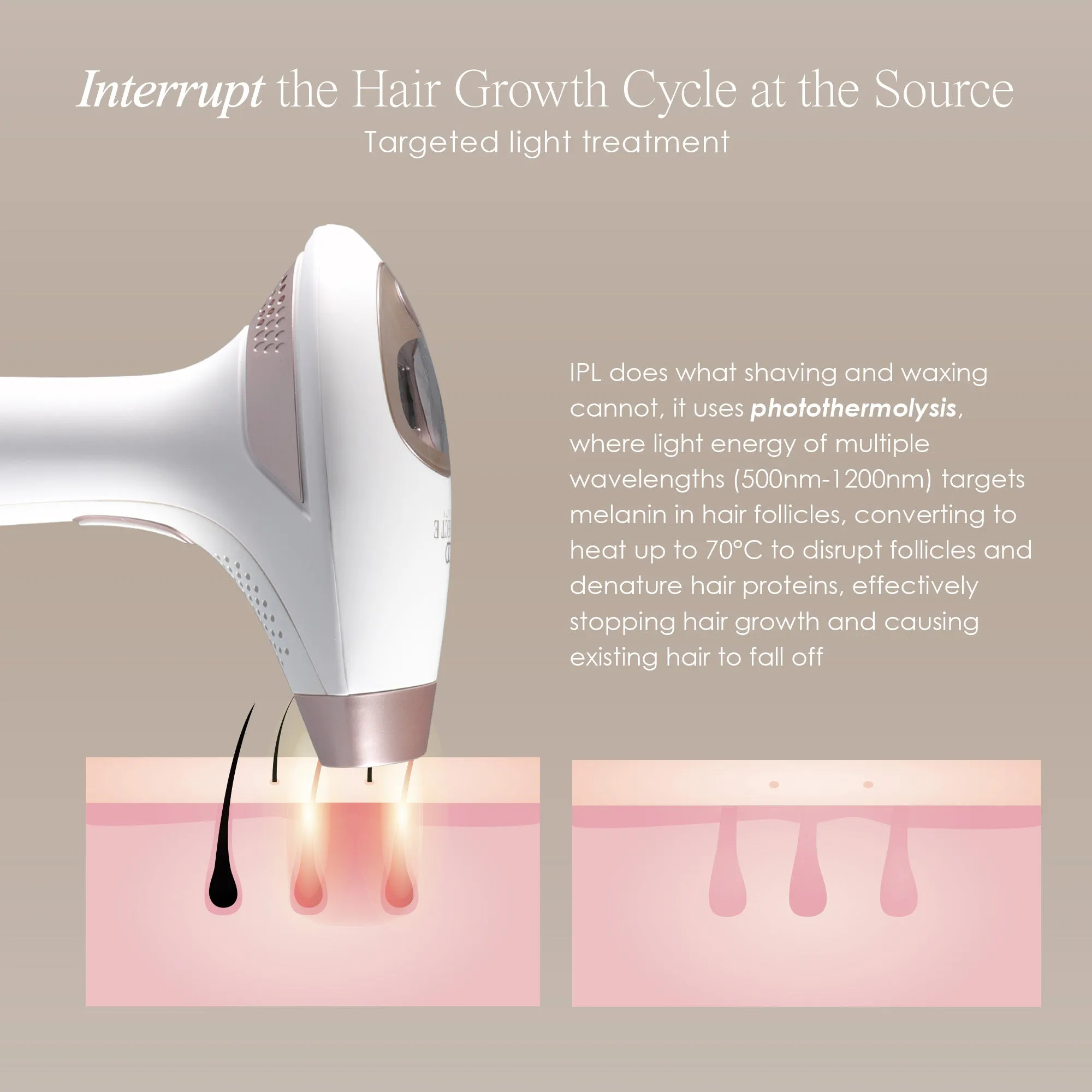 SmoothPro  | IPL Hair Removal Device