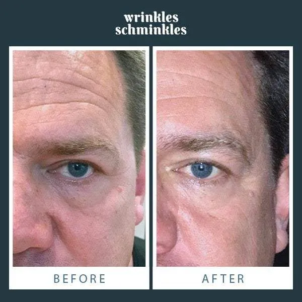 Wrinkles Schminkles Men's Eye Smoothing Kit
